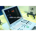 portable doppler ultrasound machine & laptop color doppler ultrasound scanner